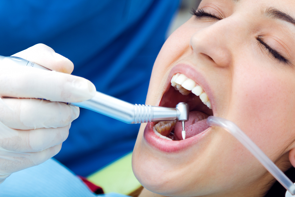 igiene dentale a foggia