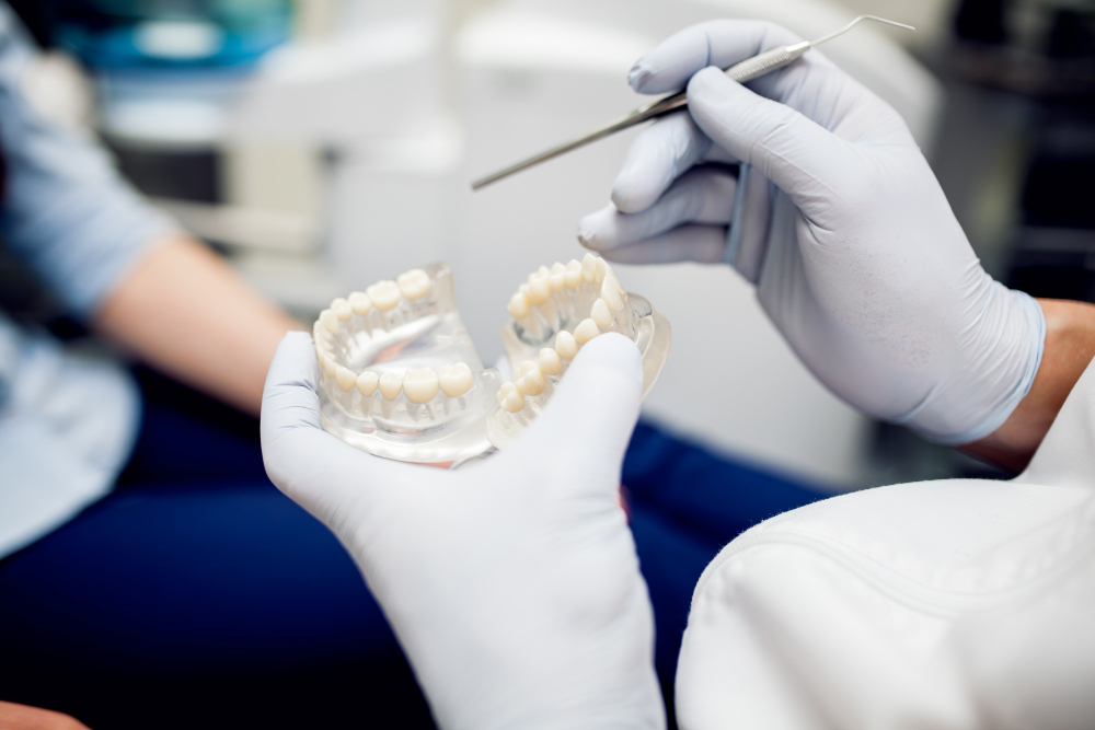 implantologia dentale foggia
